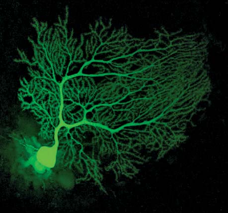 Detailed view of Purkinje fibers showing fractal branching structure